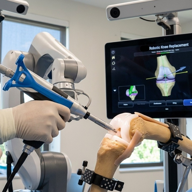 Robotic Knee Replacement illustration